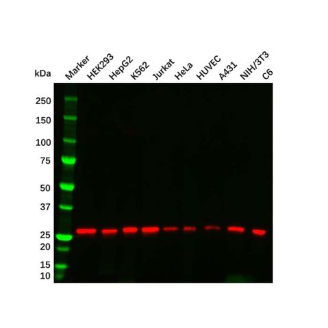 SDHB Mouse mAb,SDHB Mouse mAb