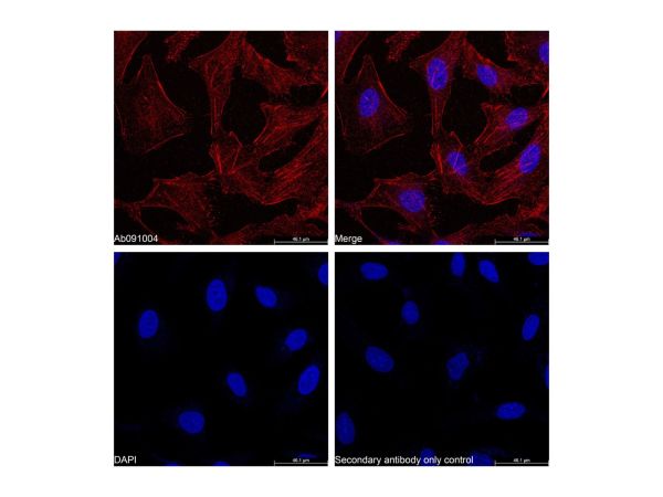 Goat Anti-Rabbit IgG H&L (Biotin),Goat Anti-Rabbit IgG H&L (Biotin)