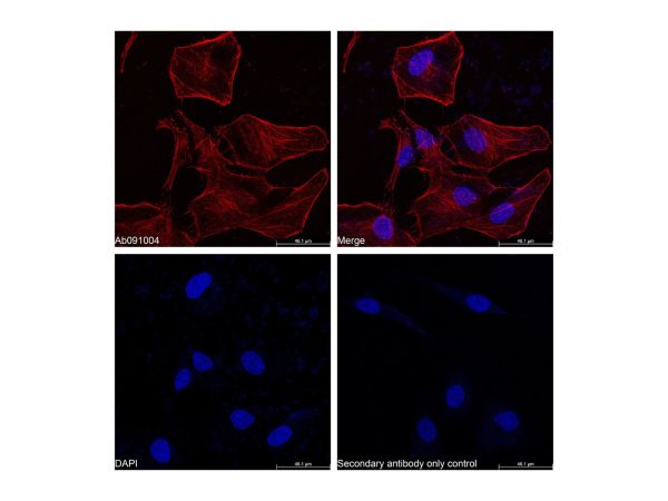 Goat Anti-Rabbit IgG H&L (Cy5),Goat Anti-Rabbit IgG H&L (Cy5)