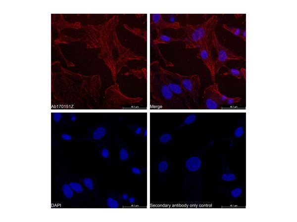 Goat Anti-Rabbit IgG H&L (TRITC),Goat Anti-Rabbit IgG H&L (TRITC)