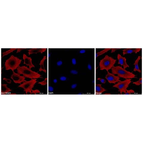 beta Actin Mouse mAb (TRITC),beta Actin Mouse mAb (TRITC)