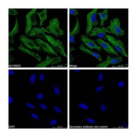 Goat Anti-Mouse IgG H&L (FITC),Goat Anti-Mouse IgG H&L (FITC)