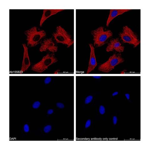 Goat Anti-Mouse IgG H&L (Cy5),Goat Anti-Mouse IgG H&L (Cy5)