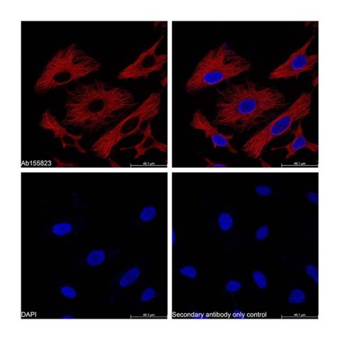 Goat Anti-Mouse IgG H&L (PE),Goat Anti-Mouse IgG H&L (PE)