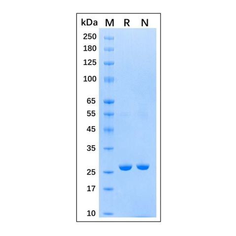 Recombinant Schistosoma japonicum GST Protein,Recombinant Schistosoma japonicum GST Protein