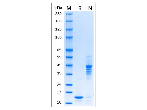 Recombinant MPXV A29L Protein,Recombinant MPXV A29L Protein