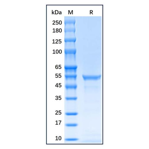 Recombinant Human Vimentin Protein,Recombinant Human Vimentin Protein