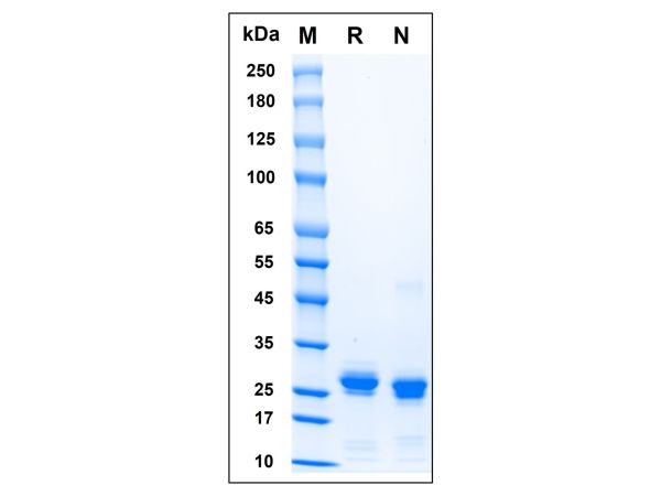 Recombinant Human HMGB1 Protein,Recombinant Human HMGB1 Protein