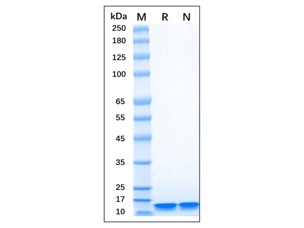 Recombinant Human LC3B Protein,Recombinant Human LC3B Protein