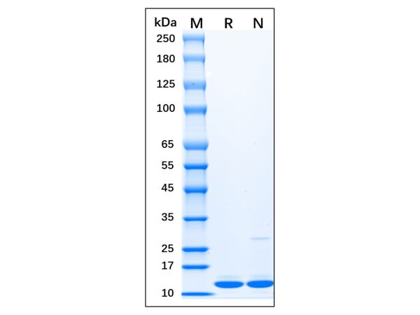 Recombinant Human Doublecortin Protein,Recombinant Human Doublecortin Protein