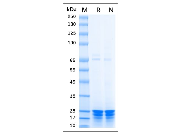 Recombinant Human TAGLN/Transgelin Protein,Recombinant Human TAGLN/Transgelin Protein