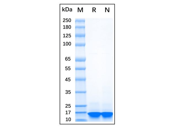 Recombinant Human Alpha-synuclein Protein,Recombinant Human Alpha-synuclein Protein