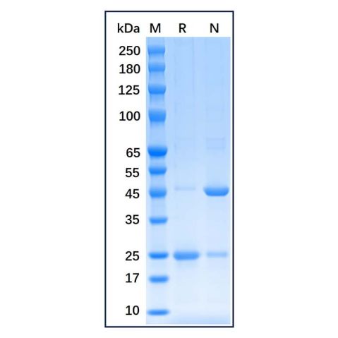 Recombinant Human Estrogen Receptor alpha Protein,Recombinant Human Estrogen Receptor alpha Protein