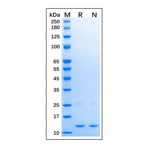 Recombinant Human SAA1 Protein,Recombinant Human SAA1 Protein