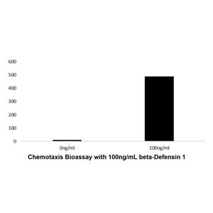 Recombinant Human beta-Defensin 1 Protein,Recombinant Human beta-Defensin 1 Protein