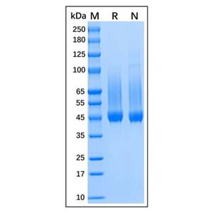 Recombinant Human Biglycan Protein,Recombinant Human Biglycan Protein