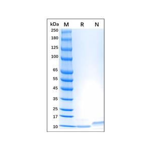 Recombinant Human CCL18 Protein,Recombinant Human CCL18 Protein