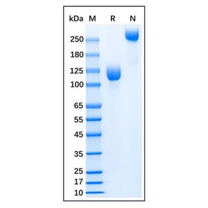 Recombinant Human gp130 Protein,Recombinant Human CD130 (gp130) protein