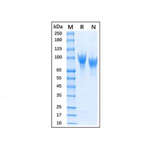 Recombinant Human CD31/PECAM-1 Protein,Recombinant Human CD31/PECAM-1 Protein