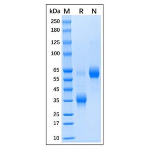 Recombinant Human Clusterin Protein,Recombinant Human Clusterin Protein