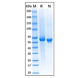 Recombinant Human DLL1 Protein,Recombinant Human DLL1 Protein