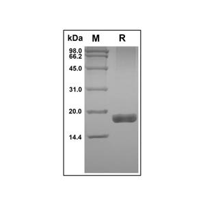 aladdin 阿拉丁 rp145269 Recombinant Human TRAIL R2/TNFRSF10B Protein Animal Free, >97% (SDS-PAGE&HPLC), Active, E.coli, No tag, 52-183 aa