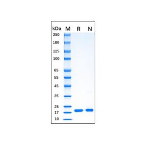 Recombinant Human FGF10 Protein,Recombinant human FGF10 protein (Active)