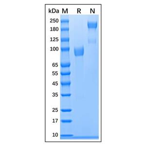 Recombinant Human FGFR4 protein,Recombinant Human FGFR4 protein