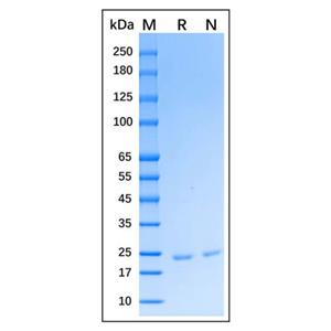 Recombinant Human Gremlin 1 Protein,Recombinant Human Gremlin 1 Protein