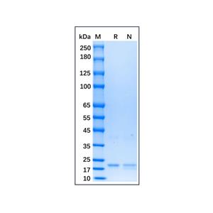 Recombinant Human IFN-omega Protein,Recombinant Human IFN-omega Protein