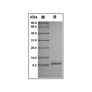 Recombinant Human IGF2 Protein,Recombinant Human IGF2 Protein