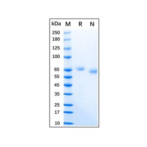 Recombinant Human IL-12 Protein,Recombinant Human IL-12 Protein