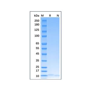 Recombinant Human IL-15 Protein,Recombinant Human IL-15 Protein