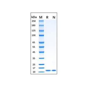 Recombinant Human IL-2 Protein,Recombinant Human IL-2 Protein