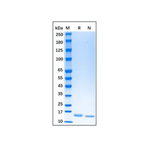 Recombinant Human IL-21 Protein,Recombinant Human IL-21 Protein