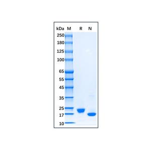 Recombinant Human IL-28A/IFN-lambda 2 Protein,Recombinant Human IL-28A/IFN-lambda 2 Protein