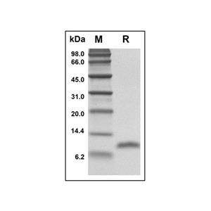 Recombinant Human LD78 beta Protein,Recombinant Human LD78 beta Protein