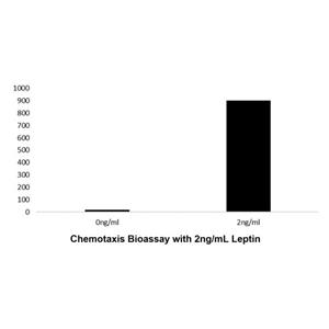 aladdin 阿拉丁 rp148245 Recombinant Human Leptin Protein Animal Free, >97%(SDS-PAGE and HPLC), Active, E.coli, No tag, 22-167 aa