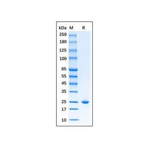 Recombinant Human Lipocalin-2/NGAL Protein,Recombinant Human Lipocalin-2/NGAL Protein