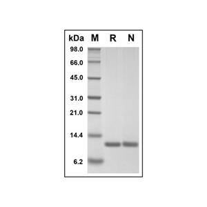 Recombinant Human MIF Protein,Recombinant Human MIF Protein