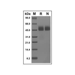 Recombinant Human Neuroserpin Protein,Recombinant Human Neuroserpin Protein