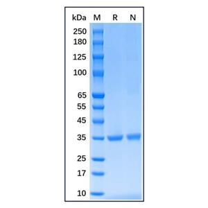 aladdin 阿拉丁 rp149860 Recombinant Human PCNA Protein Animal Free, >95% (SDS-PAGE), E.coli, His tag, 1-261 aa