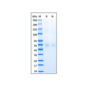 Recombinant Human PLA2G7 Protein,Recombinant Human PLA2G7 Protein