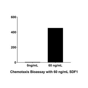 aladdin 阿拉丁 rp151342 Recombinant Human SDF1 Protein Animal Free, >95% SDS-PAGE, Active, E.coli, His, Pro23~Lys89