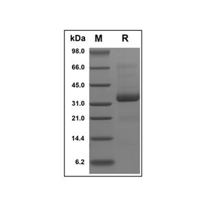 Recombinant Human SPARC Protein,Recombinant Human SPARC Protein