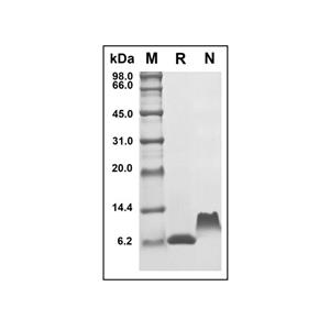 Recombinant Human TARC/CCL17 Protein,Recombinant Human TARC/CCL17 Protein