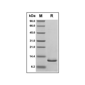 Recombinant Human TFF2 Protein,Recombinant Human TFF2 Protein