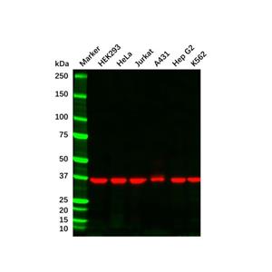 aladdin 阿拉丁 Ab155825 GAPDH Mouse mAb mAb (B08/4A11); Mouse anti Human GAPDH Antibody; WB, Flow, ICC/IF, ELISA; Unconjugated