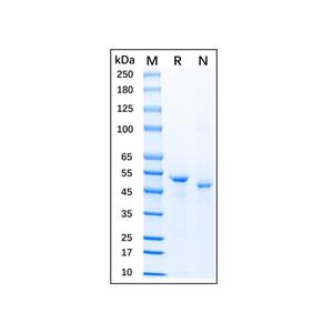 Recombinant Human TNF RII/TNFRSF1B Protein,Recombinant Human TNF RII/TNFRSF1B Protein