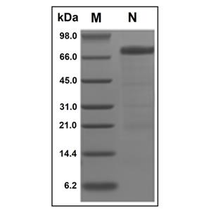 Recombinant Human HVEM/TNFRSF14 Protein,Recombinant Human HVEM/TNFRSF14 Protein